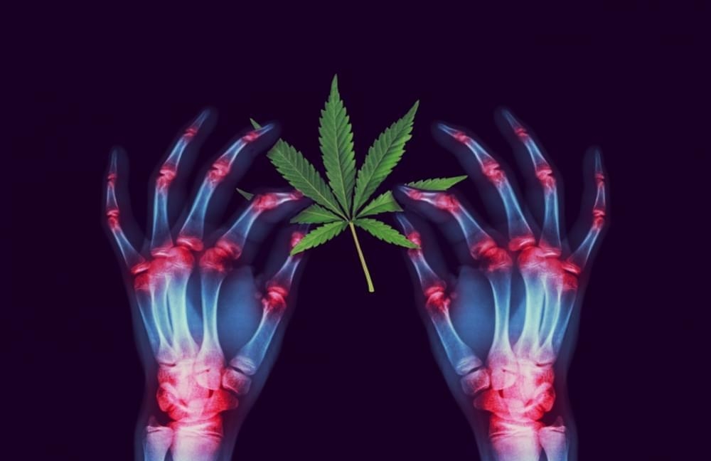 Cannabis Improves Mobility 