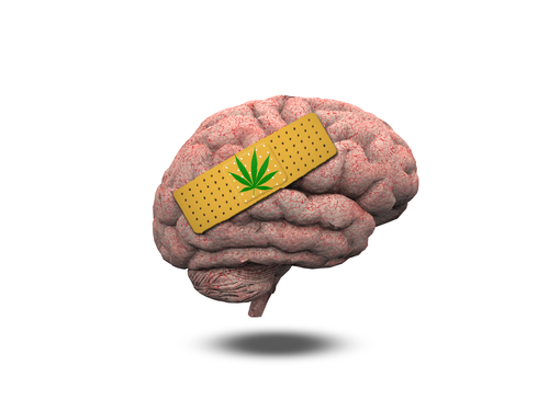How Does Marijuana Affect the Brain?